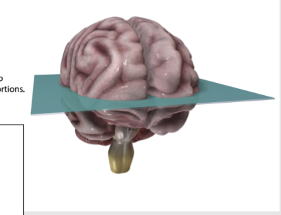 <p>Cross-section/transverse </p>