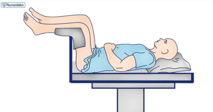 <p>assessment of femal genitalia and rectum</p>