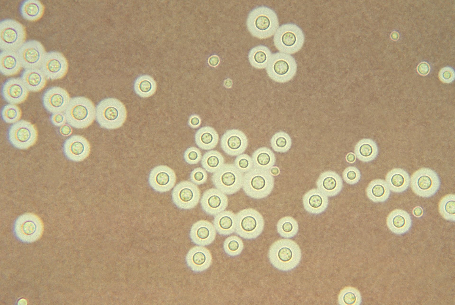 <p>cryptococcus neoformans</p>