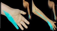 <p>Ring and pinky, ulnar side of forearm, and medial arm</p><p>Paresthesia: Little finger, ulnar side of ring finger</p>