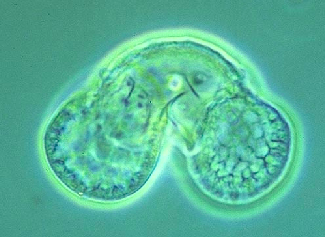 <p>Archaeplastida: Plantae: Tracheophyta: Spermatophyta: Gymnospermae: <strong>Coniferophyta (2.2: Conifer life cycle: pollen) </strong></p>