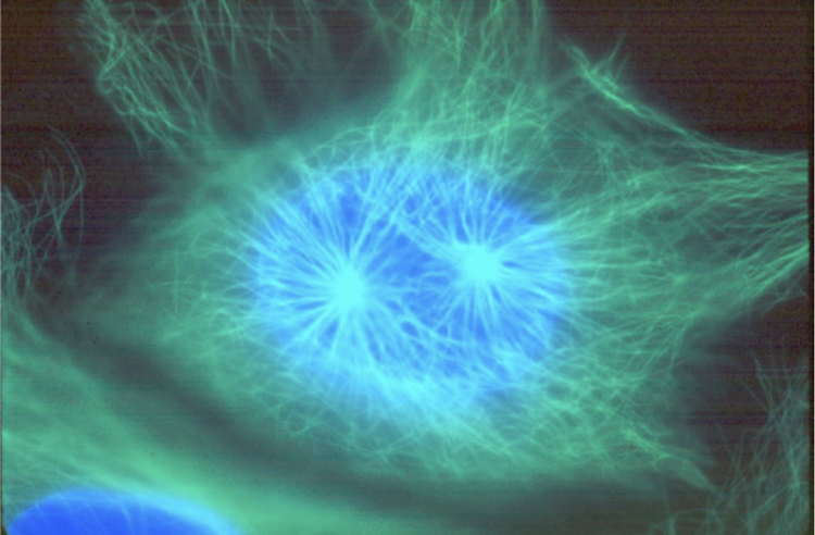 <p>what is the blue?</p>