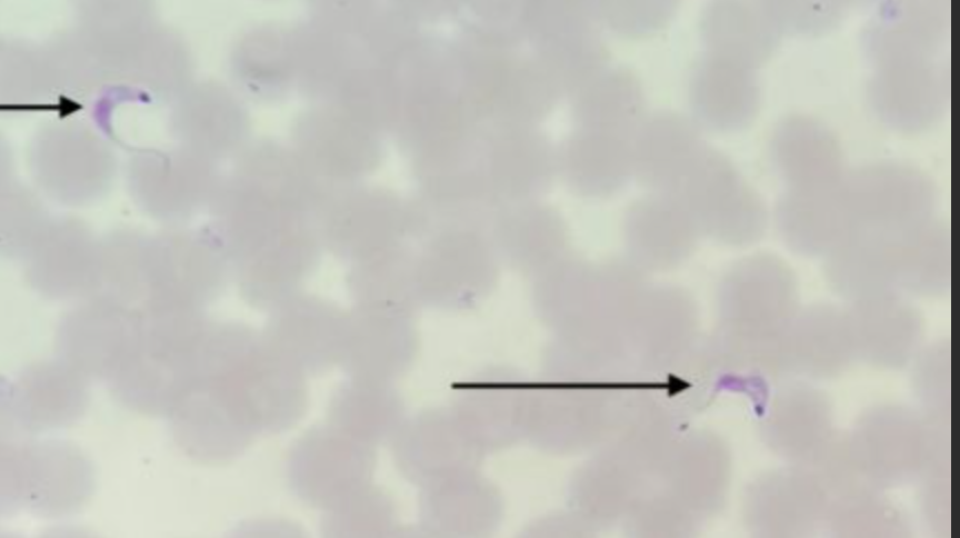 <p>Name: Trypanosoma cruzi</p><p class="p1">Stage: trypomastigote</p>