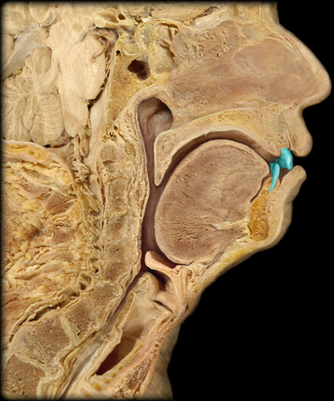 term image