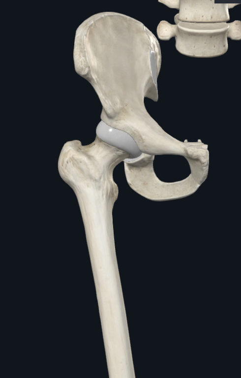 <p>what is the name of this joint and what kind of joint is it?</p>
