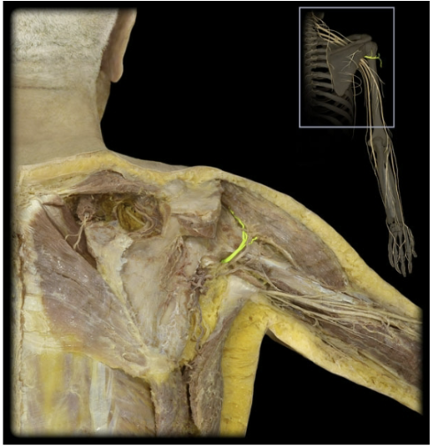 <p>What’s the spinal level of the axillary nerve?</p>