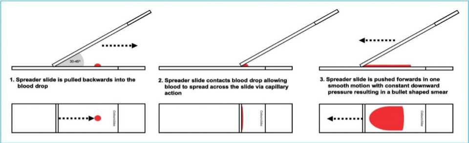 <p>place a drop of sample e.g. blood onto slide. push second slide at angle backwards into the drop, drag second slide back away from drop at an angle to smear the blood</p>