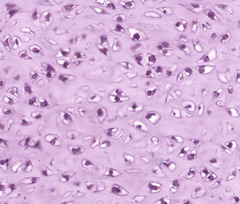 <p>What are the cells and where are they housed in?</p>
