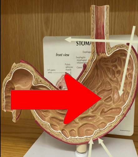term image