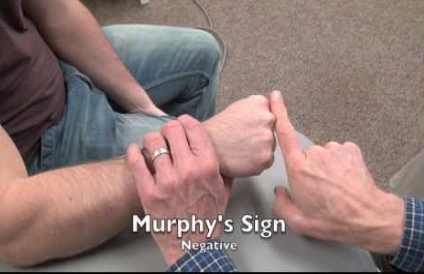 <ul><li><p><span>PURPOSE- Identify lunate dislocation</span></p></li><li><p><span>DESCRIPTION- The patient is asked to make a fist. If the head of the third metacarpal is level with the second and fourth metacarpals, the sign is positive and indicative of a lunate dislocation. Normally, the third metacarpal would project beyond (or further distally) the second and fourth metacarpals.</span></p></li></ul><p></p>