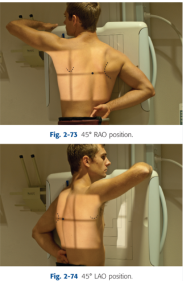 <p>oblique position which left anterior aspect closer to IR, can be erect/recumbent general body positions </p>