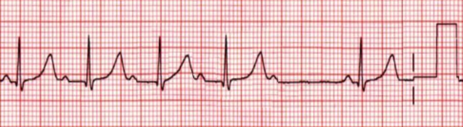 <p>what waveform is this</p>