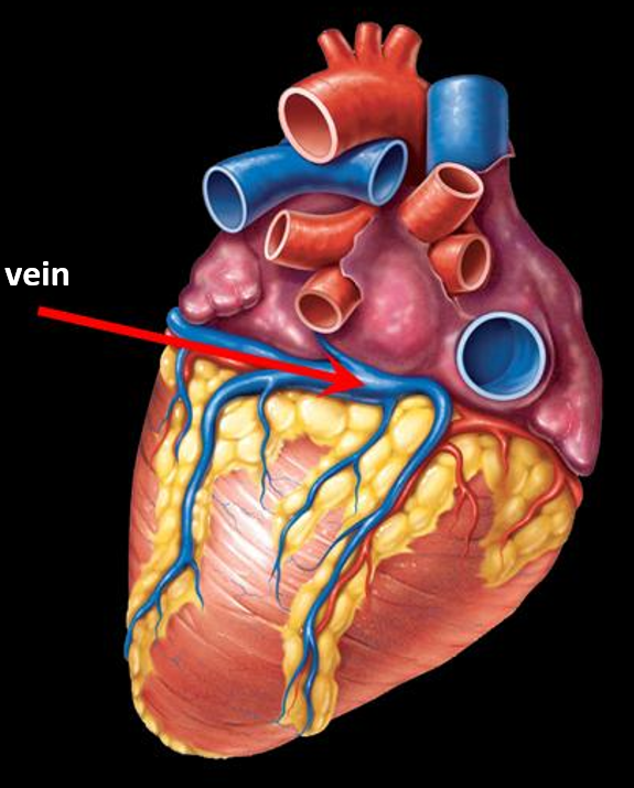 <p>Identify the vein? </p>