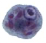 <p>What Amebae is this? Is this the trophozoite or cyst form?</p>