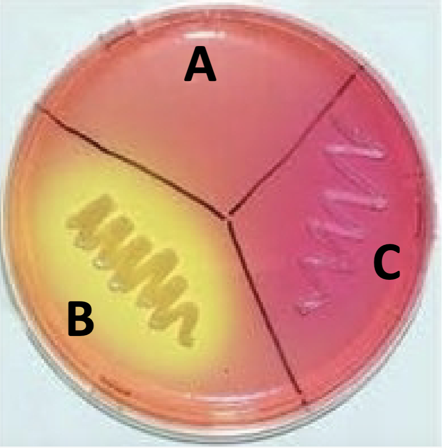 <p><strong>Name:</strong> Mannitol Salt Agar(MSA)</p><p><strong>SELECTIVE AGENT:</strong> 7.5% NaCl</p><p><strong>SELECTS FOR</strong>: salt tolerant bacteria (halophiles)</p><p><strong>DIFFERENTIAL AGENTS</strong>:</p><p>1<u>. Mannitol: </u>fermentable sugar</p><p><u>2. </u><span style="color: red;"><u>Phenol Red:</u></span><u> </u>pH indicator</p><p>- Acidic = <mark data-color="#d5d714" style="background-color: rgb(213, 215, 20); color: inherit;">yellow</mark></p><p>- Neutral = <span style="color: red;">red</span></p><p>- Basic = <span style="color: rgb(210, 27, 224);">shocking pink</span> (like a fuschia)</p><p><strong>DIFFERENTIATES BETWEEN:</strong></p><p>- <u>Mannitol fermentors</u>:<mark data-color="#e9d91b" style="background-color: rgb(233, 217, 27); color: inherit;"> yellow </mark>around the colony(halo)</p><p>- <u>Non-mannitol fermentors</u>: <span style="color: red;">red </span>or <span style="color: rgb(247, 14, 243);">shocking pink</span> around the colony</p><p>Extra info: WHEN AN ORG IS NOT SALT TOLERANT WE CAN’T TELL IF IT IS MANNITOL OR NON-MANNITOL, JUST THAT IT’S NON-SALT TOLERANT</p><p></p>