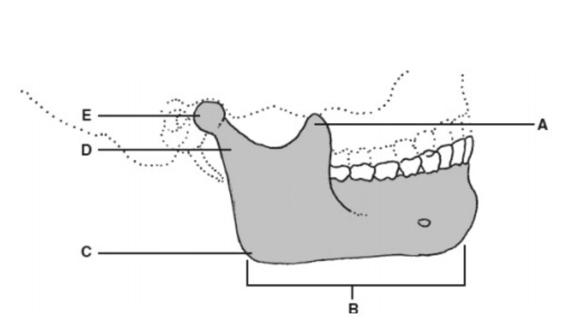 <p>E</p>