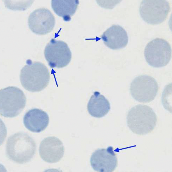 <p>name the type of RBC inclusion</p>