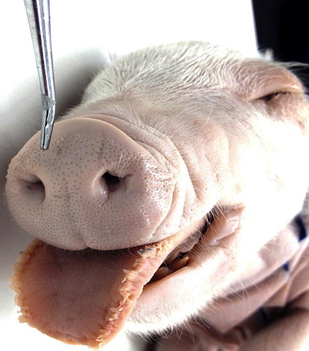 <p><span style="background-color: transparent;">The groove located between the nose and upper lip that forms during embryonic development.</span></p>