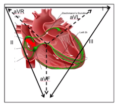 <p>I, II, III, aVF, V3 -V6 nov - pozitīva</p><p>negatīva - aVR</p>
