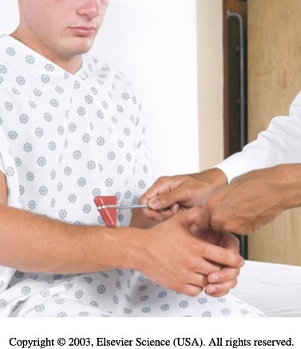 <p>hold pt.'s thumbs to suspend forearm in relaxation and strike forearm directly approximately 2-3 cm above radial styloid process</p><p>normally flexion, forearm supinates</p>