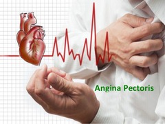 <p>A condition characterized by chest pain due to myocardial ischemia, often related to coronary artery disease (CAD).</p>