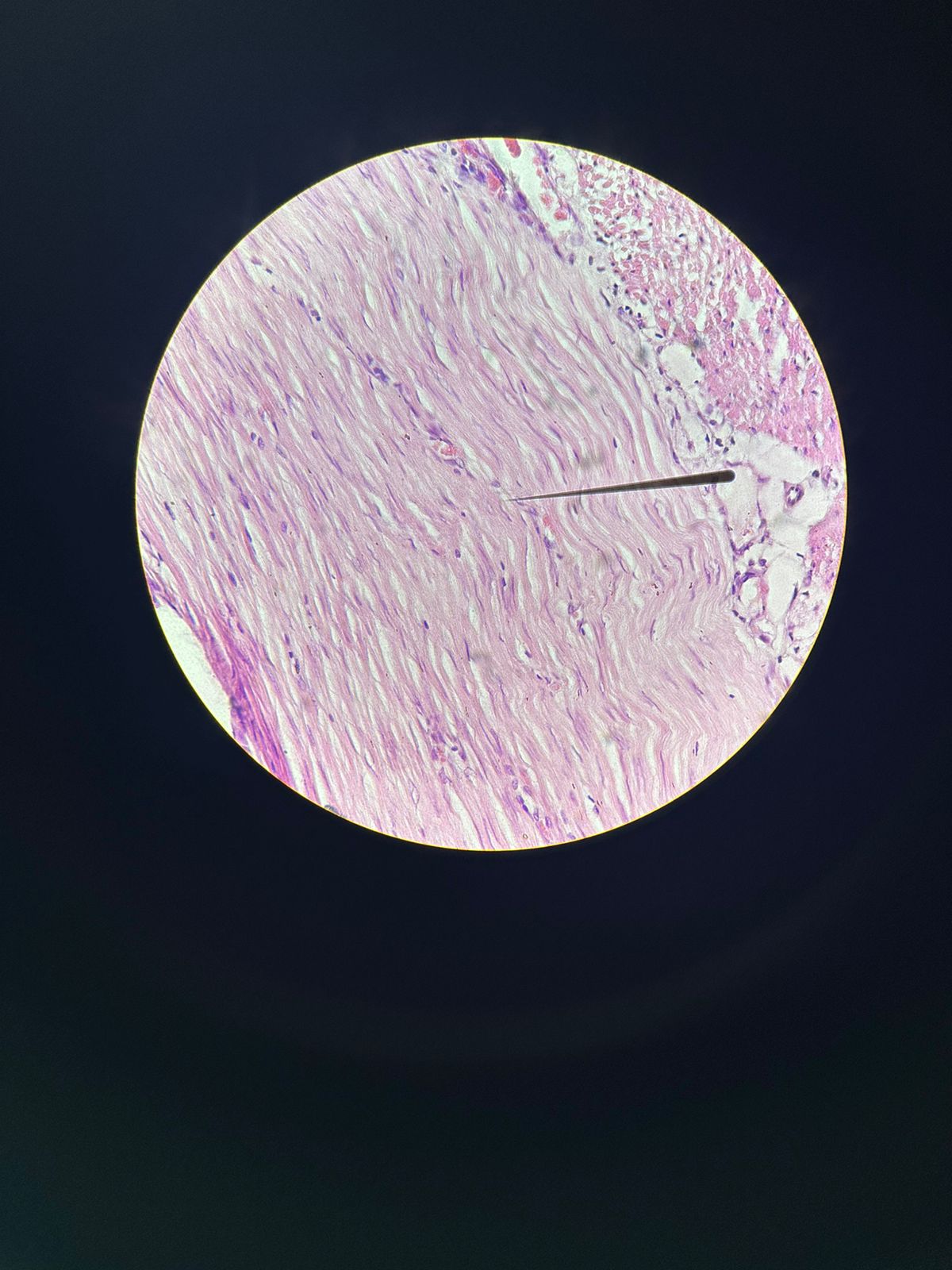 term image
