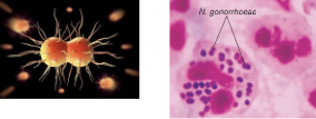 <p><strong>STIs: </strong>Unique Characteristics for <u>Neisseria Gonorrhoeae or Gonorrhea </u></p>
