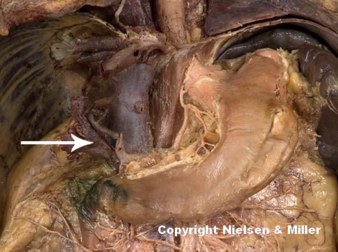 <p>The indicated vessel is the_. The indicated vessel receives blood from capillaries of gastrointestinal organs and the _ and delivers it to the _</p>