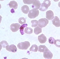 <p>Identify the organism</p>