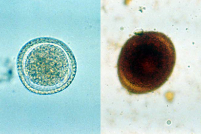<p><span>They have a rough shell and a brown central mass that fills most of the shell</span></p>