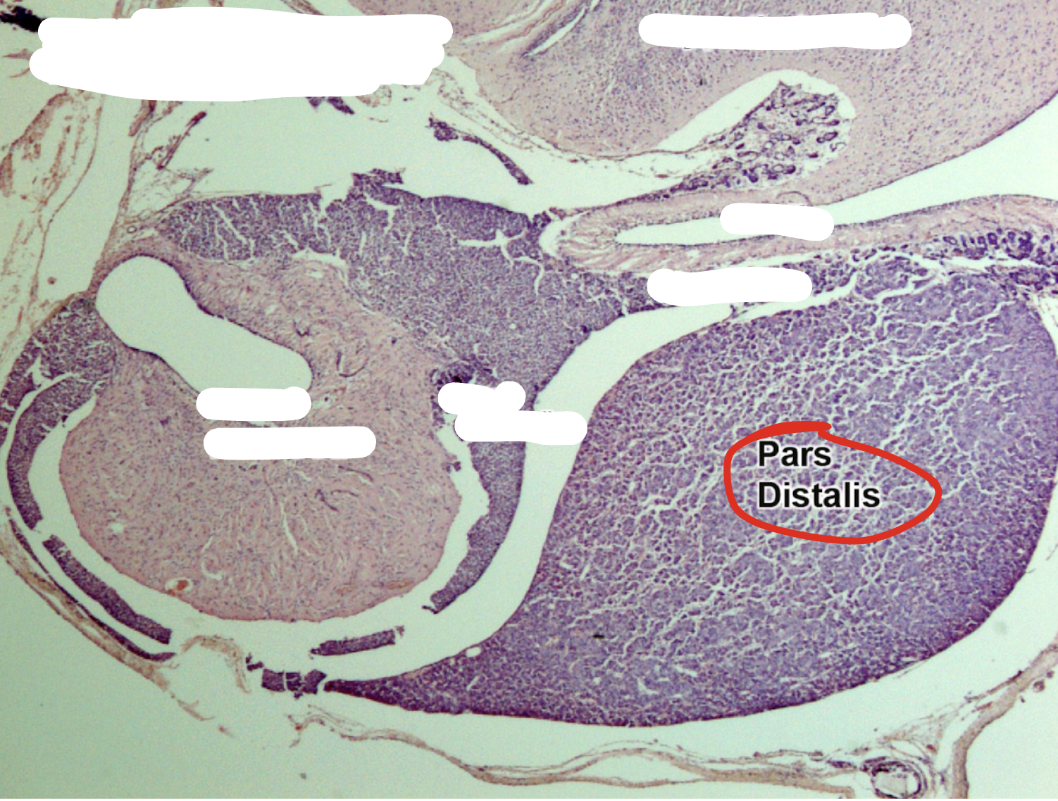 <p>Anterior pituitary </p>