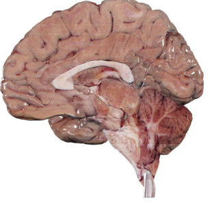 <ul><li><p>divides the body into right and left sides vertically.</p></li></ul><p>• Median or midsagittal: if this plane courses down the middle of the body</p><p>• Longitudinal or parasagittal: if it divides the body into unequal</p><p>right and left sides</p><p></p>