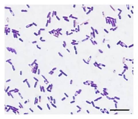 <p>They can be gram variable, and the spores are visible</p>