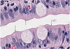 <p>What structure is being indicated by the arrows in this slide of a small intestine?</p>