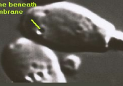 <p>Due to redundant membrane beneath the plasma membrane</p>