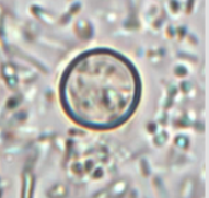 <p>genus, species, stage</p>