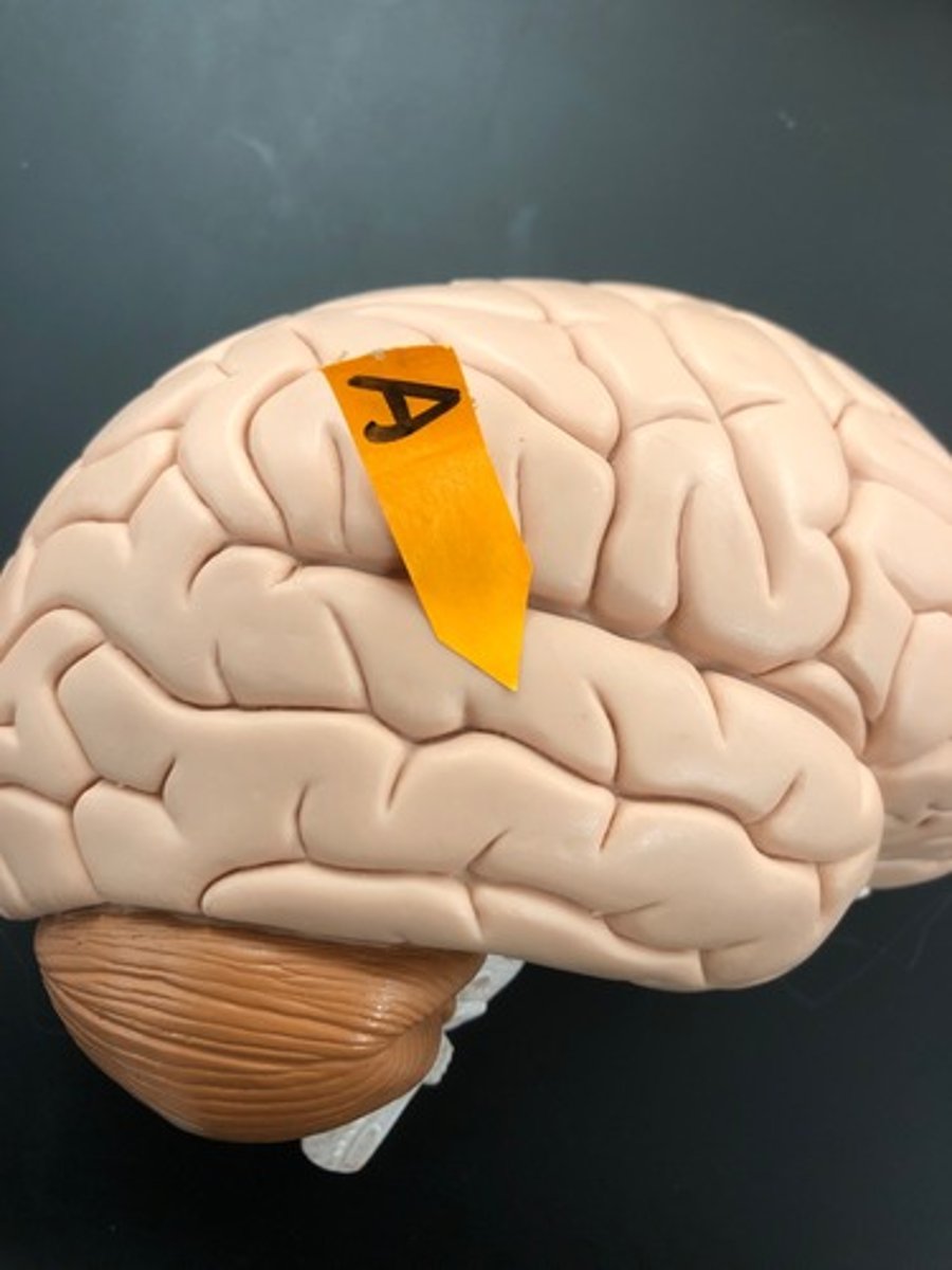 <p>Identify the structure (general name for a ridge on the surface of the brain).</p>