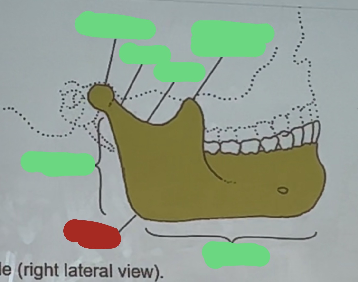<p>name the bone marking highlighted in red</p>