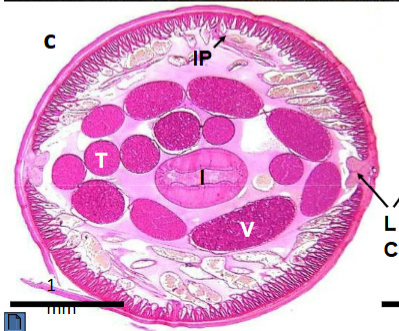 <p>What is labeled as V</p>