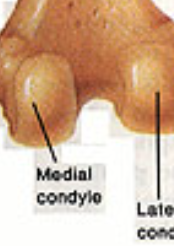 <p>Rounded bump</p>