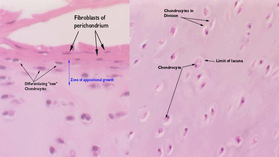<p>Cartilaginous Growth</p>