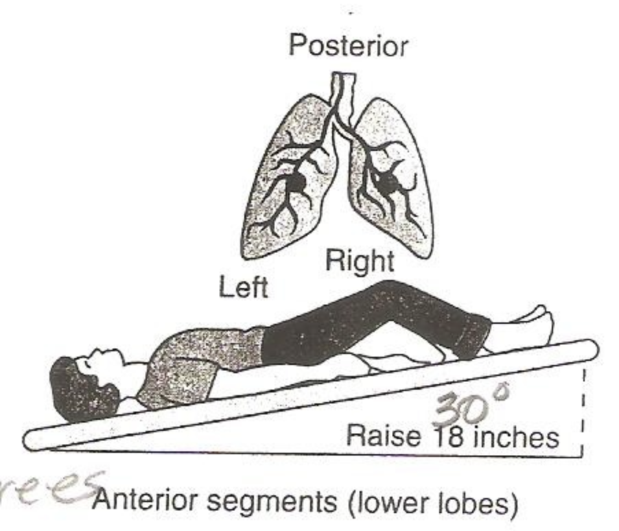 <p>anterior lower lobes</p>