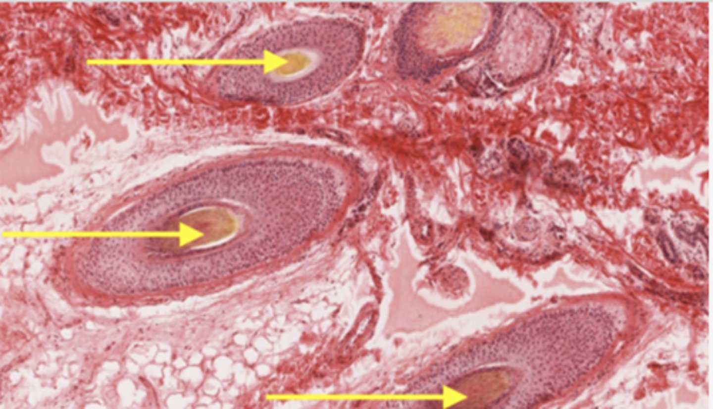 <p>Identify the structure</p>