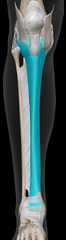 <p>What bone is in blue?</p>