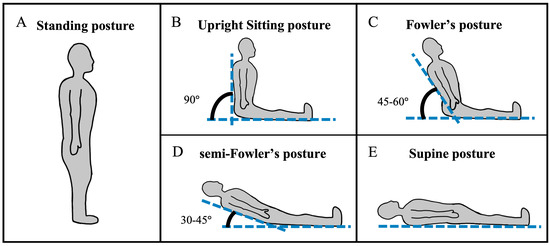 <ol><li><p>Sitting upright at a 45-60 degree angle</p></li></ol><ul><li><p>promotes lung expansion and easier breathing.\</p></li></ul><ol start="2"><li><p>A 30-45 degree incline - often used for feeding or comfort.</p></li></ol><p></p>
