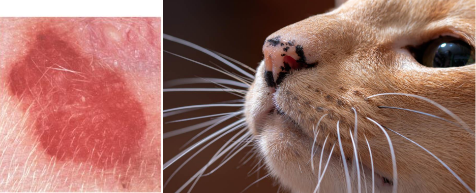 <ul><li><p><strong>primary lesion</strong></p></li><li><p><strong>flat</strong>, different color to adjacent skin</p></li><li><p>ex. hemorrhage, lentigo (increased pigment), vitiligo (loss of pigment)</p></li></ul><p></p>