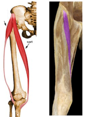 <p>Femoral N</p>