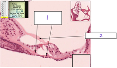 <p>What is the structure at 1</p>