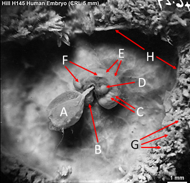 <ol><li><p>Label A, B, C, D, E, F, G and H</p></li><li><p>What view is this?</p></li></ol><p></p>
