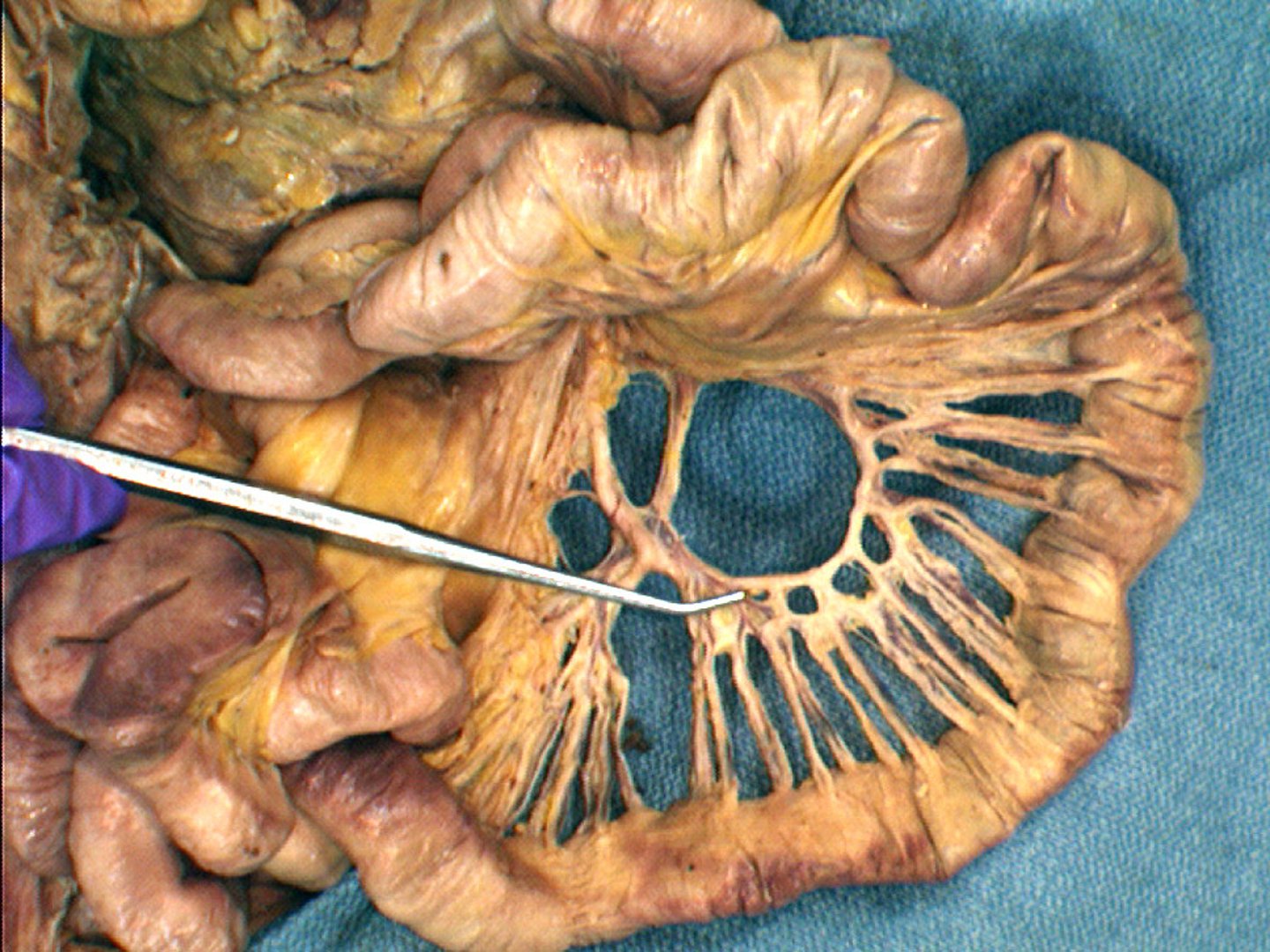 <p>loops of arteries around the jejunum and ileum</p>